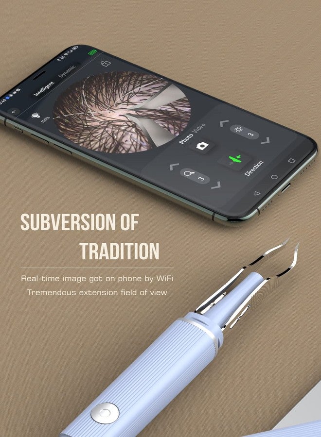 scopepick Hair Removal Tweezer with 1080p Camera, Ultimate Precision: Tweezer with Camera - Perfect for Delicate Tasks! - - Ear Hair Eyebrow Tweezer - Image 3